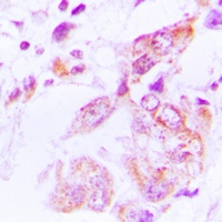 Anti-HSP90 beta (Phospho-S226) Antibody
