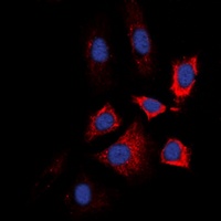 Anti-HSP90 beta (Phospho-S226) Antibody