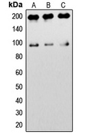 IGF1 Receptor Antibody