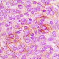 Anti-CD222 Antibody