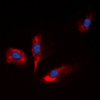 Anti-IGFBP1 Antibody