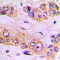 Anti-IKK beta Antibody