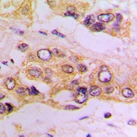 Anti-IKK beta Antibody