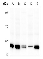 IKK gamma Antibody