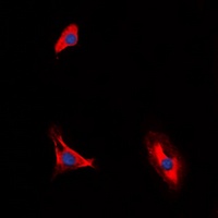 Anti-CD210a Antibody