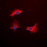 Anti-CD213a1 Antibody