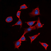 CD122 (Phospho-Y364) Antibody