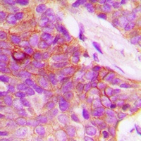 Anti-MUC1 Antibody