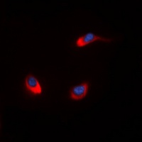 Anti-MUC1 Antibody