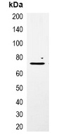 mCherry-tag antibody