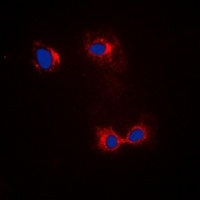 Anti-Beta-actin Antibody
