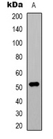 Alpha-tubulin Mouse Monoclonal Antibody