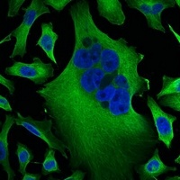 Anti-Beta-tubulin Antibody