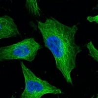 Anti-Beta-tubulin Antibody