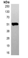 Anti-Beta-tubulin Antibody