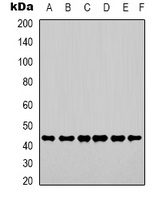 Beta-actin Rabbit Polyclonal Antibody