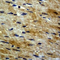 Anti-Beta-tubulin Antibody