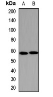Cytochrome P450 1A2 Rabbit Polyclonal Antibody