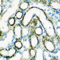 Anti-FGF2 Antibody