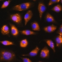 Anti-FGF2 Antibody