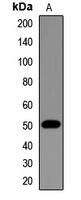 Beta-tubulin Rabbit Polyclonal Antibody
