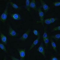 Anti-NUP98 Antibody