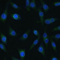 NUP98 antibody