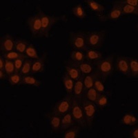 Anti-GTF2I Antibody