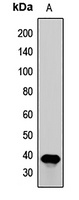 Borealin Rabbit Polyclonal Antibody
