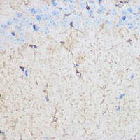 S100B antibody