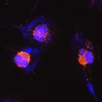 Anti-S100-B Antibody