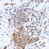 Anti-cIAP2 Antibody