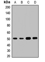 ILK Rabbit Polyclonal Antibody