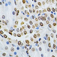 Anti-ILK Antibody