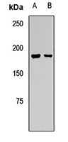 NMDAR2A Rabbit Polyclonal Antibody