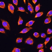 Anti-NMDAR2A Antibody