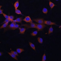 Anti-PPP3R1 Antibody