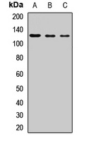 PI3K p110 beta Rabbit Polyclonal Antibody