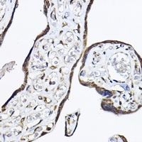 Anti-TRF4 Antibody