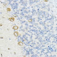 Anti-LRRC59 Antibody