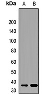 NOSIP Rabbit Polyclonal Antibody