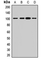 ADAM22 Rabbit Polyclonal Antibody