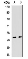 RGS13 Rabbit Polyclonal Antibody