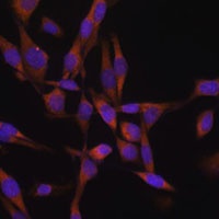 Anti-UBE2O Antibody