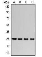 RPL8 Rabbit Polyclonal Antibody