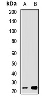 Tim23 Rabbit Polyclonal Antibody