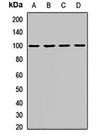 IL-17RA Rabbit Polyclonal Antibody