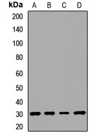 SCN1B Rabbit Polyclonal Antibody