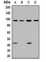 Dystroglycan Rabbit Polyclonal Antibody