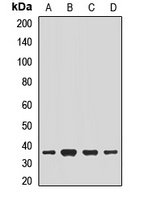 NACA1 Antibody